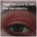 Çıkartma