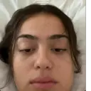 Çıkartma