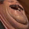 Çıkartma