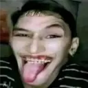 Çıkartma